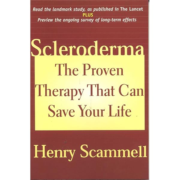 語学・辞書・学習参考書 Scleroderma The Scleroderma Book: A Guide for Patients and Families